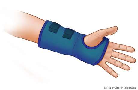 Wrist splint