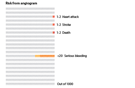 Out of 1,000 people who have an angiogram, fewer than 20 will have serious bleeding; 1 to 2 people will die; 1 to 2 will have a stroke; and 1 to 2 will have a heart attack.