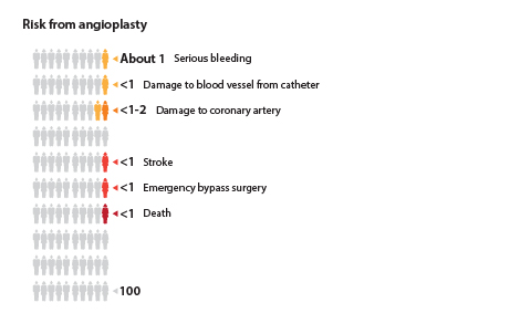 Out of 100 people who have angioplasty, about 1 will have serious bleeding or damage to a blood vessel from the catheter; about 1 to 2 will have damage to the coronary artery; about 1 will have a stroke or  need emergency bypass surgery; and about 1 will die.