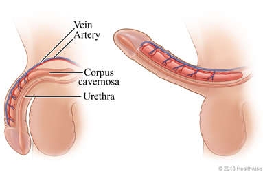 Side view of flaccid penis  and erect penis, showing changes in major blood vessels and corpus cavernosa during an erection