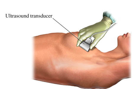 Picture of breast ultrasound