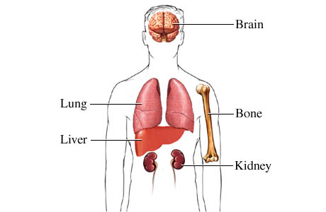 Examples of structures visible on a CT scan